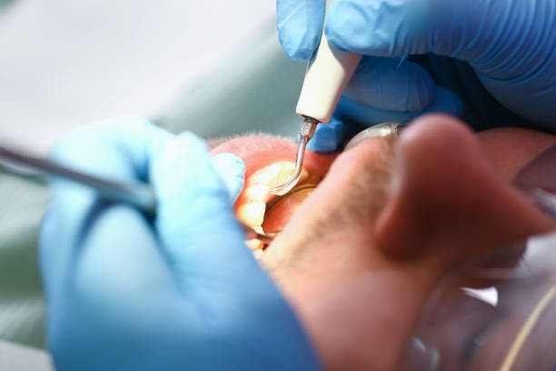Best Mobile Emergency Dentist in Colchester, IL