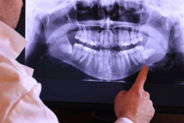 Best Broken or Cracked Tooth Emergency Dentist in Colchester, IL