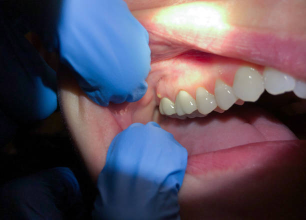 Best Emergency Cosmetic Dentistry in Colchester, IL