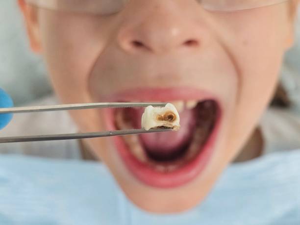 Best Orthodontic Emergency Dentist in Colchester, IL